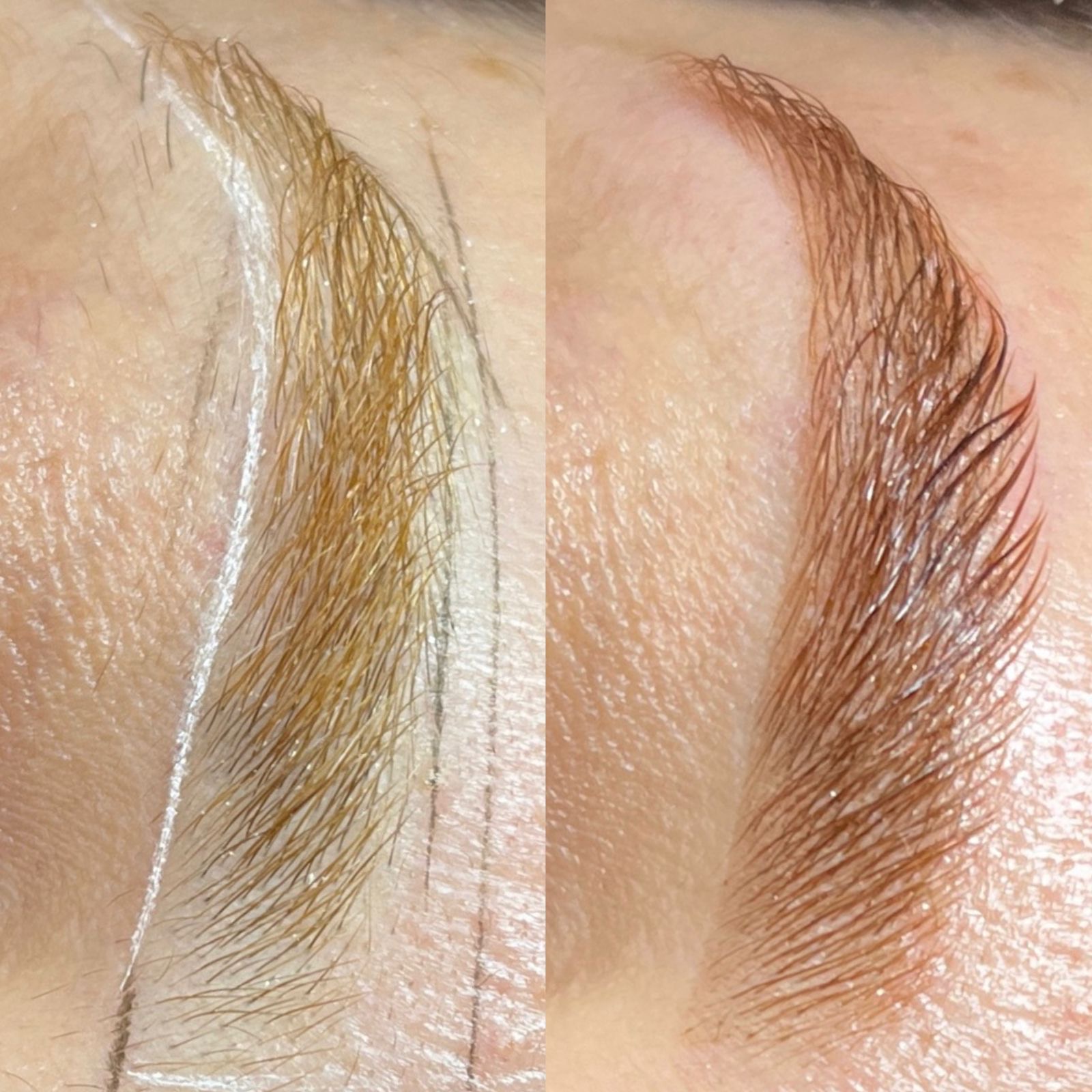 Técnica Profissional